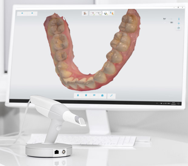 Phoenix 3D Cone Beam and 3D Dental Scans